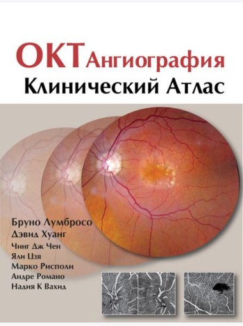ОКТ-ангиография. Клинический атлас