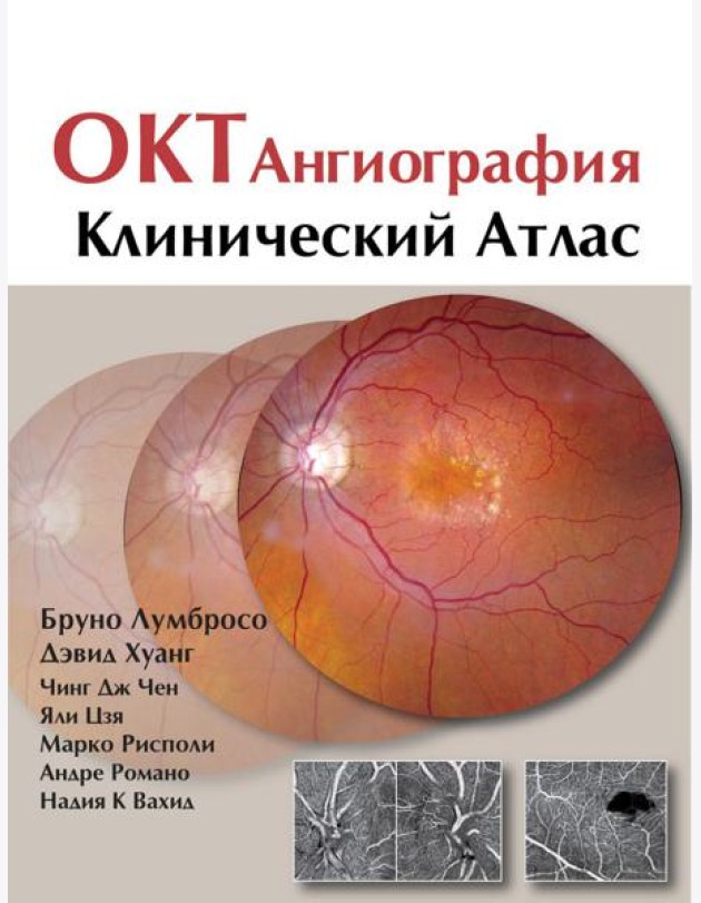 ОКТ-ангиография. Клинический атлас