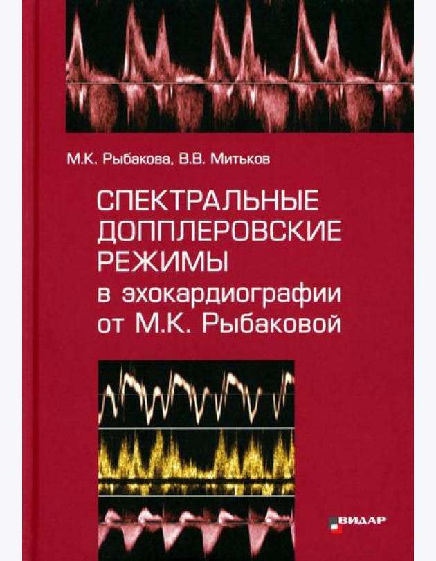 Спектральные допплеровские режимы в эхокардиографии от Рыбаковой М.К.