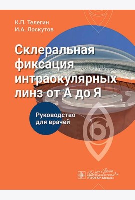 Склеральная фиксация интраокулярных линз от А до Я: руководство для врачей