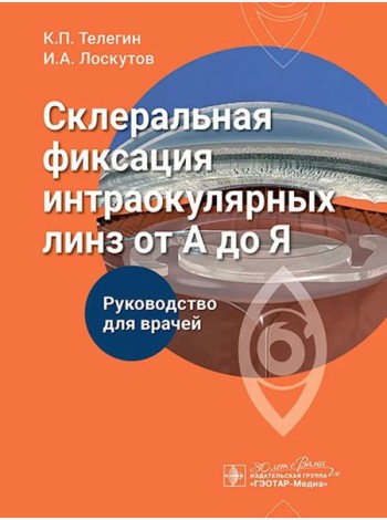 Склеральная фиксация интраокулярных линз от А до Я: руководство для врачей