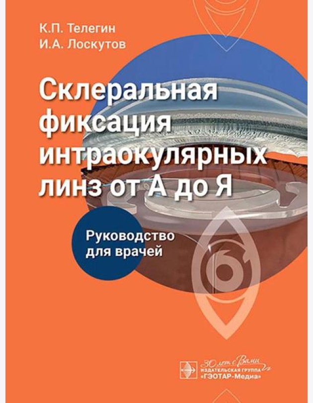 Склеральная фиксация интраокулярных линз от А до Я: руководство для врачей