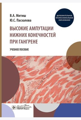 Высокие ампутации нижних конечностей при гангрене: Учебное пособие