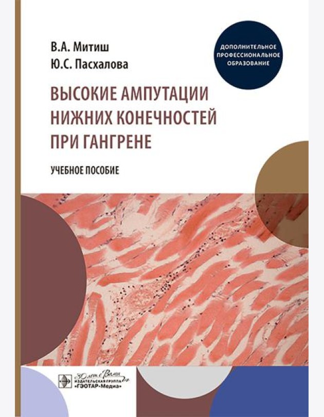 Высокие ампутации нижних конечностей при гангрене: Учебное пособие