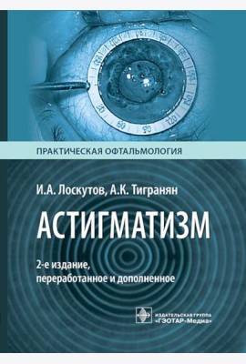 Астигматизм. 2-е изд., перераб. и доп