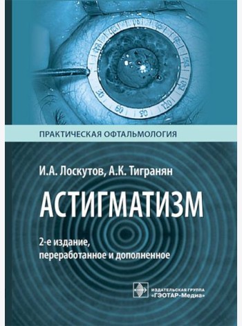 Астигматизм. 2-е изд., перераб. и доп
