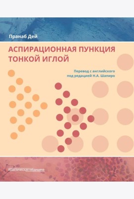 Аспирационная пункция тонкой иглой. Трактовка результатов и диагностические проблемы
