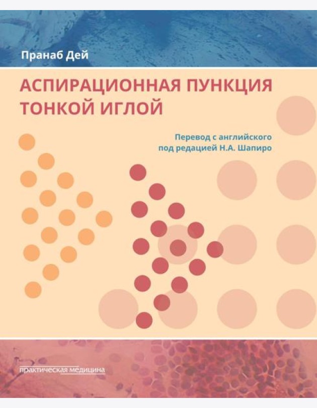 Аспирационная пункция тонкой иглой. Трактовка результатов и диагностические проблемы