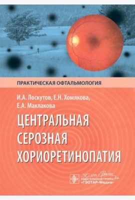 Центральная серозная хориоретинопатия