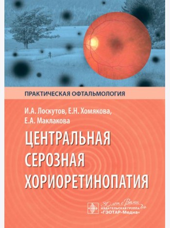 Центральная серозная хориоретинопатия