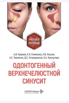 Одонтогенный верхнечелюстной синусит : учебное пособие