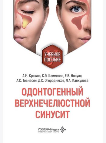 Одонтогенный верхнечелюстной синусит : учебное пособие