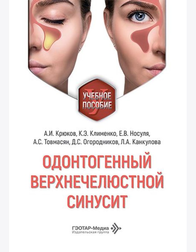 Одонтогенный верхнечелюстной синусит : учебное пособие