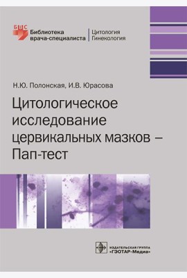 Цитологическое исследование цервикальных мазков — Пап-тест