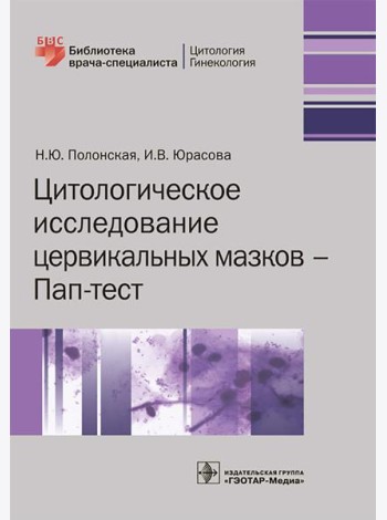 Цитологическое исследование цервикальных мазков — Пап-тест