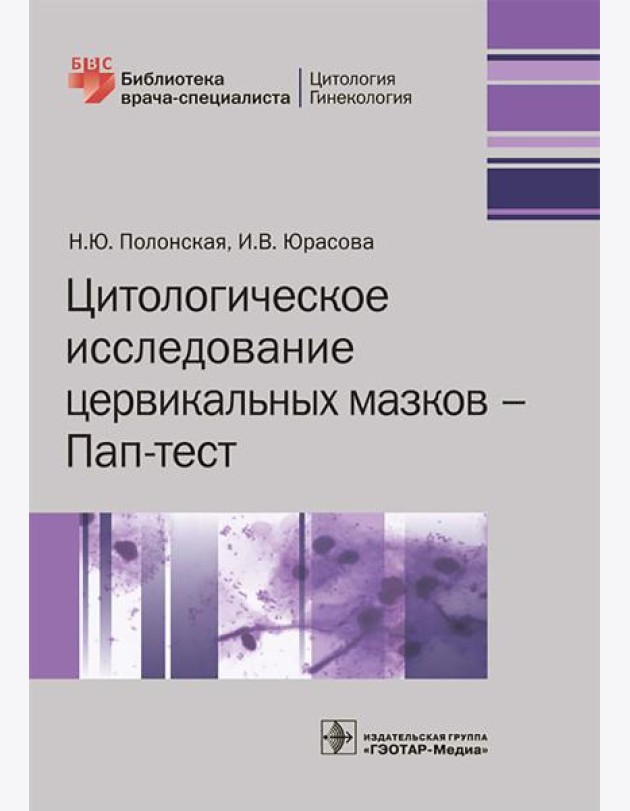 Цитологическое исследование цервикальных мазков — Пап-тест