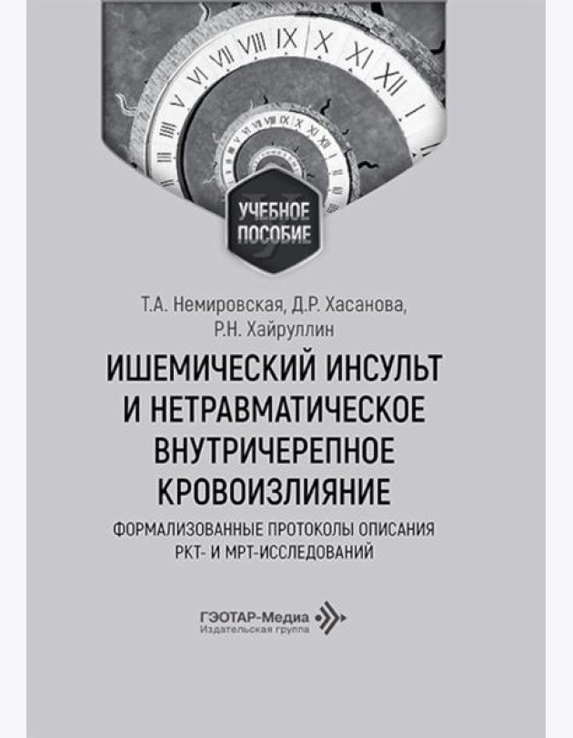 Ишемический инсульт и нетравматическое внутричерепное кровоизлияние: формализованные протоколы описания РКТ- и МРТ-исследований: Учебное пособие