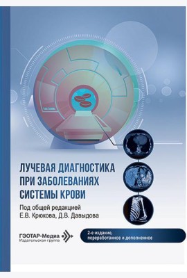 Лучевая диагностика при заболеваниях системы крови . 2-е изд., перераб. и доп