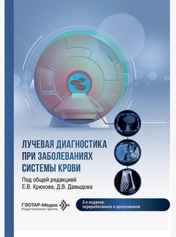 Лучевая диагностика при заболеваниях системы крови . 2-е изд., перераб. и доп