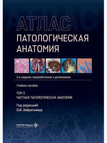 Патологическая анатомия. Атлас. В 2 т. Т. 2: Частная патологическая анатомия: Учебное пособие. 2-е изд., перераб. и доп