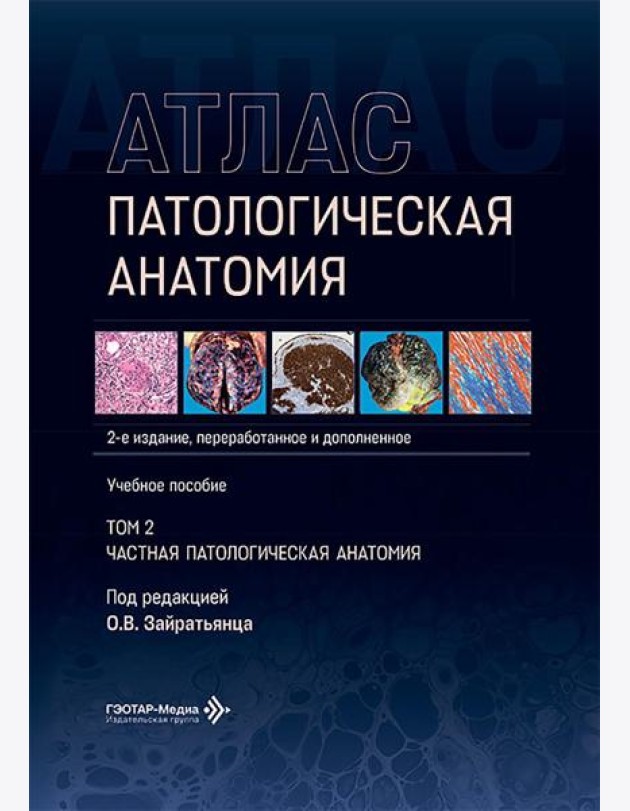 Патологическая анатомия. Атлас. В 2 т. Т. 2: Частная патологическая анатомия: Учебное пособие. 2-е изд., перераб. и доп