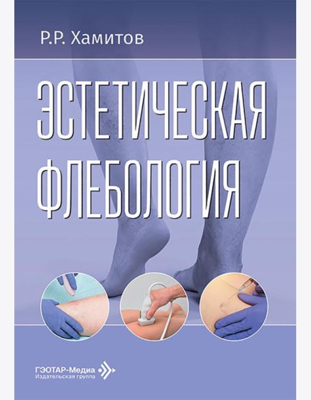 Эстетическая флебология