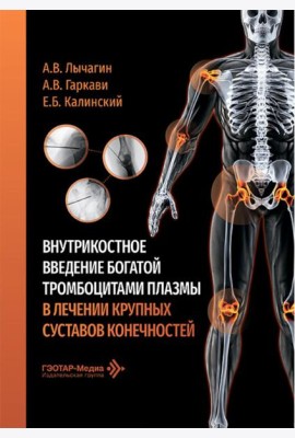 Внутрикостное введение богатой тромбоцитами плазмы в лечении крупных суставов конечностей