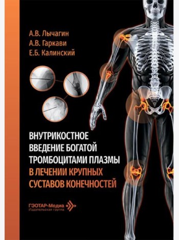 Внутрикостное введение богатой тромбоцитами плазмы в лечении крупных суставов конечностей