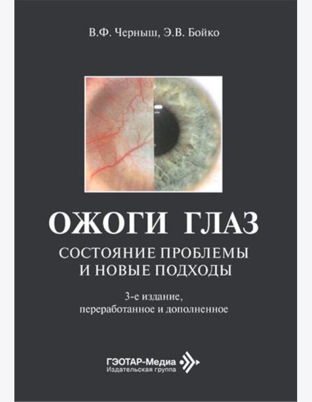 Ожоги глаз. Состояние проблемы и новые подходы. 3-е изд., перераб. и доп