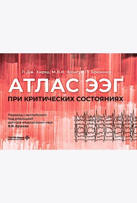 Атлас ЭЭГ при критических состояниях