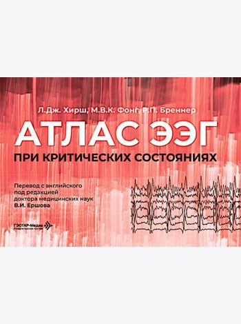 Атлас ЭЭГ при критических состояниях