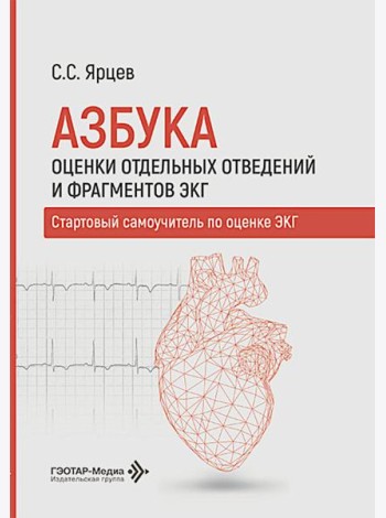 Азбука оценки отдельных отведений и фрагментов ЭКГ. Стартовый самоучитель по оценке ЭКГ
