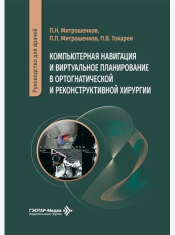 Компьютерная навигация и виртуальное планирование в ортогнатической и реконструктивной хирургии: руководство для врачей
