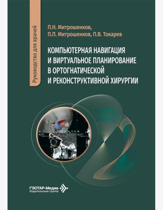 Компьютерная навигация и виртуальное планирование в ортогнатической и реконструктивной хирургии: руководство для врачей