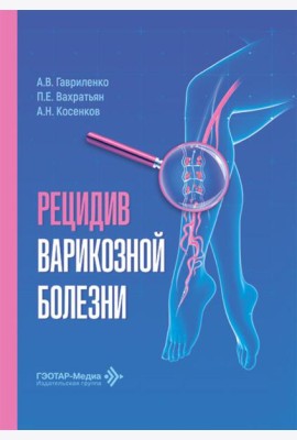 Рецидив варикозной болезни