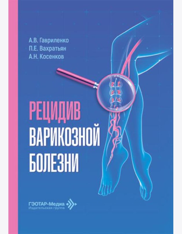 Рецидив варикозной болезни
