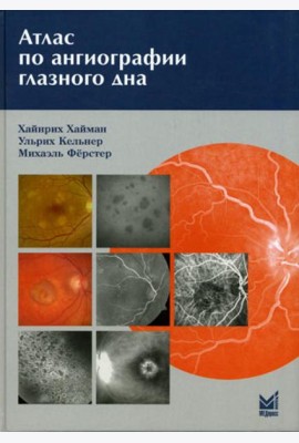 Атлас по ангиографии глазного дна