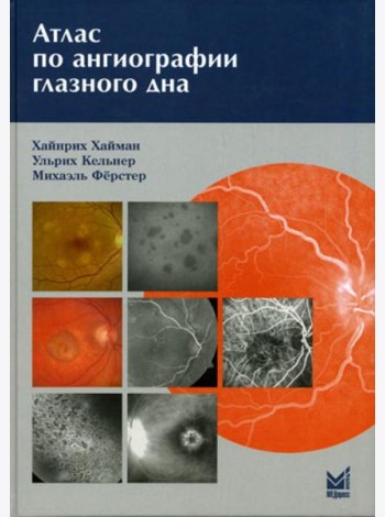 Атлас по ангиографии глазного дна