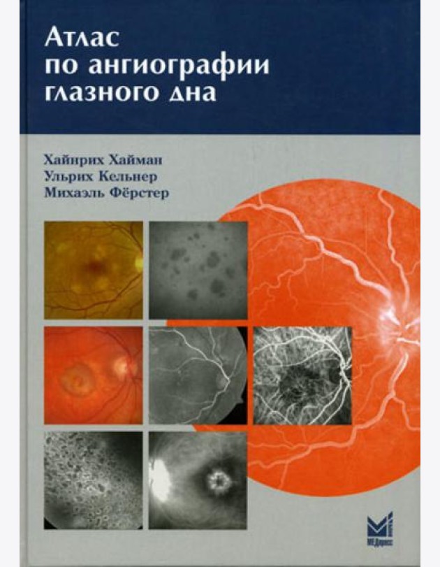 Атлас по ангиографии глазного дна