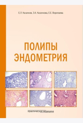 Полипы эндометрия: Учебное пособие