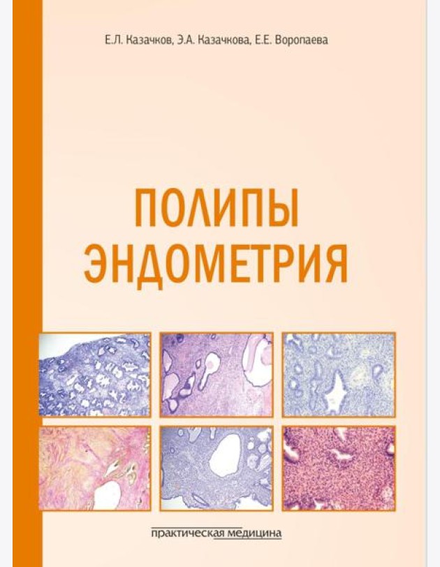 Полипы эндометрия: Учебное пособие