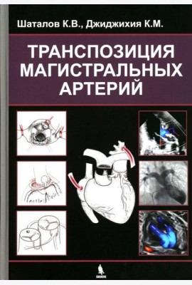 Транспозиция магистральных артерий