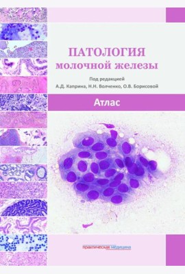 Патология молочной железы. Атлас