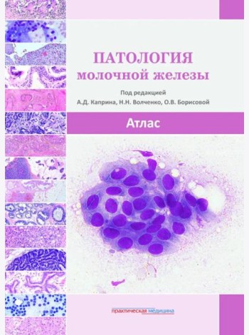 Патология молочной железы. Атлас