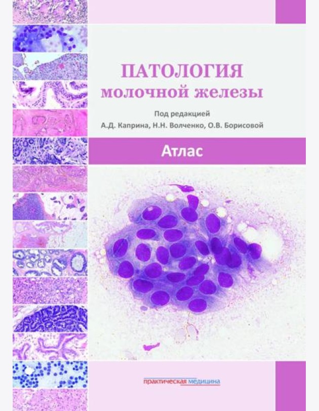 Патология молочной железы. Атлас