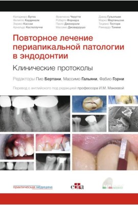 Повторное лечение периапикальной патологии в эндодонтии. Клинические протоколы