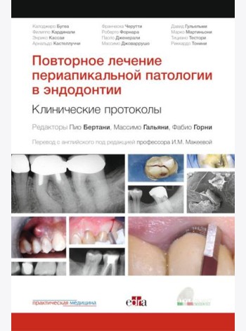 Повторное лечение периапикальной патологии в эндодонтии. Клинические протоколы