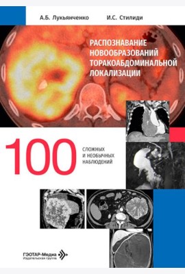 Распознавание новообразований торакоабдоминальной локализации: 100 сложных и необычных наблюдений