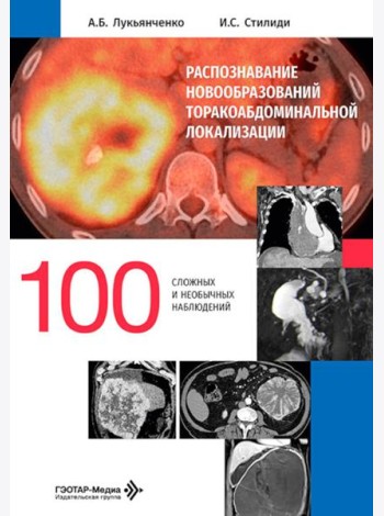 Распознавание новообразований торакоабдоминальной локализации: 100 сложных и необычных наблюдений