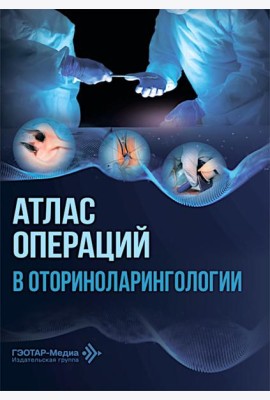 Атлас операций в оториноларингологии